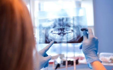 exame estudos radiográficos na neox radiologia digital odontologica odontologia uberaba